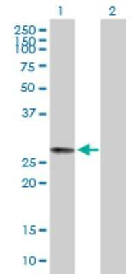 Western Blot: MRAP2 Antibody [H00112609-B01P]