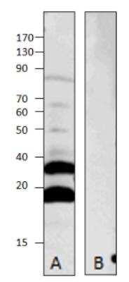 Western Blot: MRAP2 Antibody [NBP3-12226]