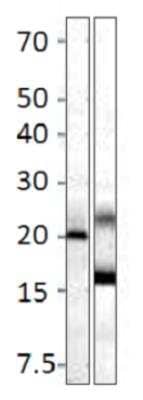 Western Blot: MRAP2 Antibody [NBP3-12227]