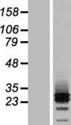 Western Blot: MRAP2 Overexpression Lysate [NBL1-08508]