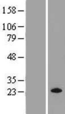 Western Blot: M-Ras/R-Ras3 Overexpression Lysate [NBP2-07474]