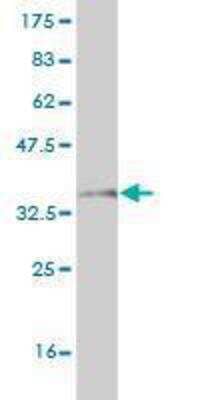 Western Blot: Mrc2 Antibody (2D7) [H00009902-M01]