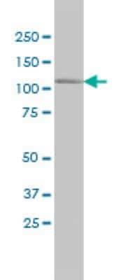 Western Blot: MRCK Antibody (1G7) [H00008476-M01]