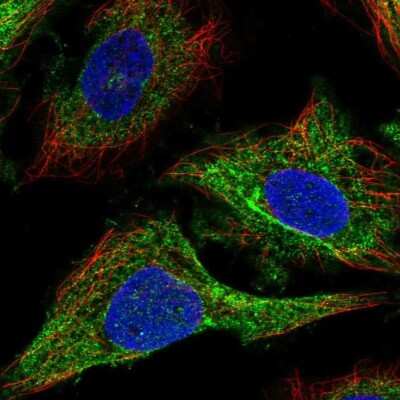 Immunocytochemistry/ Immunofluorescence: MRCK Antibody [NBP2-55964]