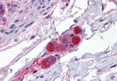 Immunohistochemistry-Paraffin: MRCK Antibody [NB300-829]
