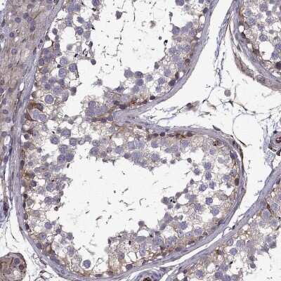 Immunohistochemistry-Paraffin: MRCK Antibody [NBP2-55964]