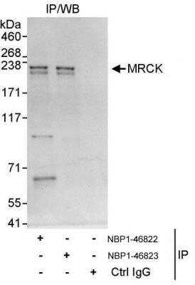 Immunoprecipitation: MRCK Antibody [NBP1-46822]