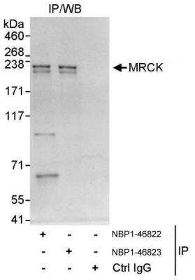 Immunoprecipitation: MRCK Antibody [NBP1-46823]