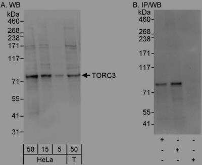 Immunoprecipitation: MRCK Antibody [NBP1-46823]