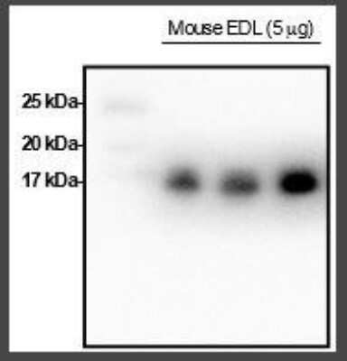 Western Blot: MRCL3 [p Ser19, p Ser20] Antibody [NB100-1687]