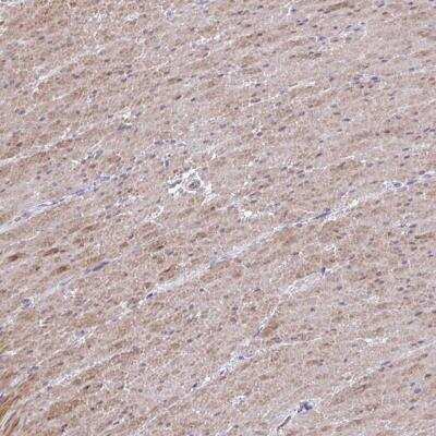 Immunohistochemistry-Paraffin: MYL9 Antibody [NBP2-46856]