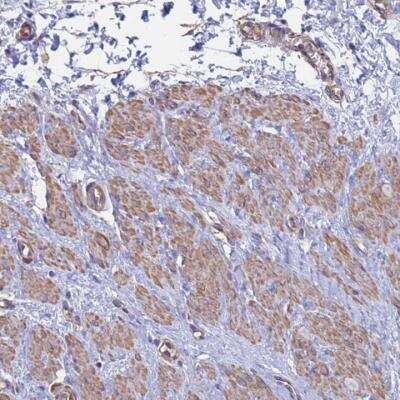 Immunohistochemistry-Paraffin: MRLC2 Antibody [NBP2-54719]