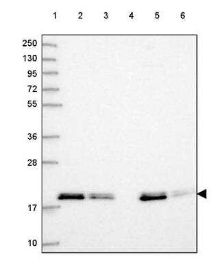 Western Blot: MRLC2 Antibody [NBP2-54719]