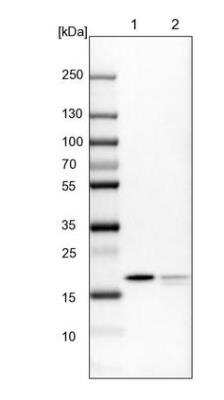 Western Blot: MRLC2 Antibody [NBP2-54719]