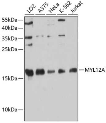 Western Blot: MRCL3 AntibodyAzide and BSA Free [NBP2-93080]