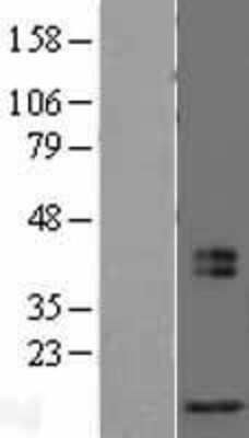 Western Blot: MRFAP1L1 Overexpression Lysate [NBL1-13222]