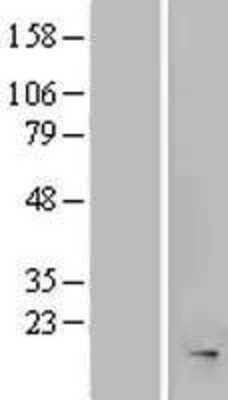 Western Blot: MRFAP1L1 Overexpression Lysate [NBP2-05407]