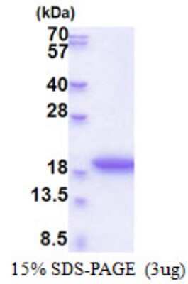 SDS-PAGE: Recombinant Human MRFAP1L1 His Protein [NBP2-51583]