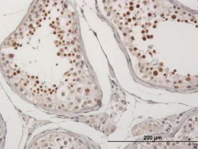 Immunohistochemistry-Paraffin: MRG-binding protein Antibody [H00055257-B01P]
