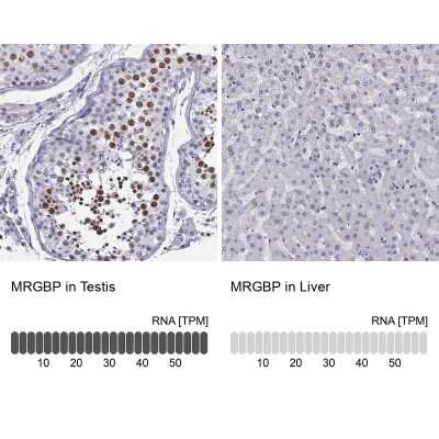 Immunohistochemistry-Paraffin: MRG-binding protein Antibody [NBP1-84936]