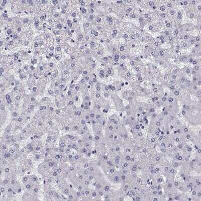 Immunohistochemistry-Paraffin: MRG-binding protein Antibody [NBP1-84936]