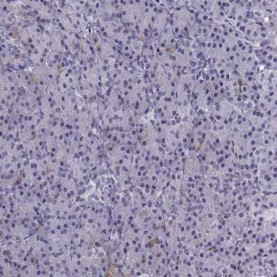 Immunohistochemistry-Paraffin: MRG-binding protein Antibody [NBP1-84936]
