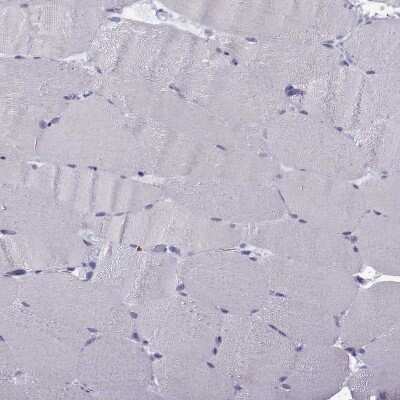 Immunohistochemistry-Paraffin: MRG-binding protein Antibody [NBP1-84936]