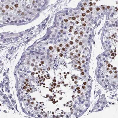 Immunohistochemistry-Paraffin: MRG-binding protein Antibody [NBP1-84936]