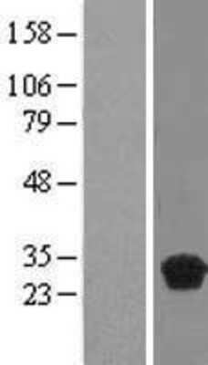 Western Blot: MRG-binding protein Overexpression Lysate [NBL1-08368]