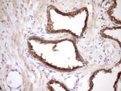 Immunohistochemistry: MRG15 Antibody (OTI5D2) [NBP2-45908]