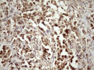 Immunohistochemistry: MRG15 Antibody (OTI5D2) [NBP2-45908]