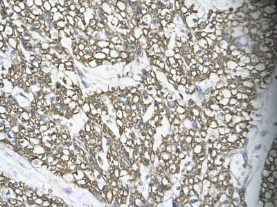 Immunohistochemistry: MRG15 Antibody [NBP1-57832]