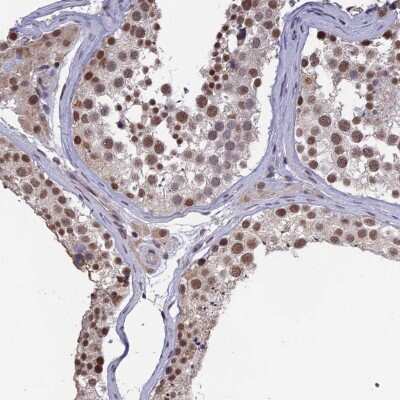 Immunohistochemistry-Paraffin: MRG15 Antibody [NBP1-84937]