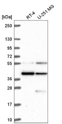 Western Blot: MRG15 Antibody [NBP2-56097]