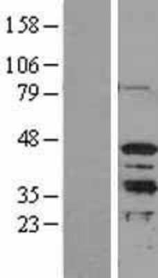 Western Blot: MRG15 Overexpression Lysate [NBL1-13183]