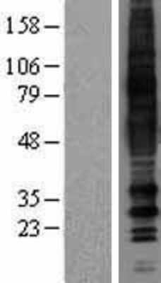 Western Blot: MRGPRD Overexpression Lysate [NBP2-04452]