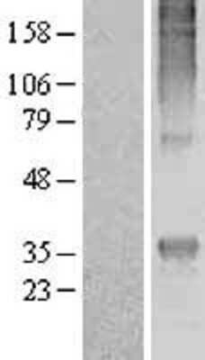 Western Blot: MRGPRE Overexpression Lysate [NBL1-13224]