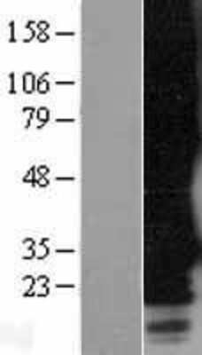 Western Blot: MRGPRF Overexpression Lysate [NBL1-13225]