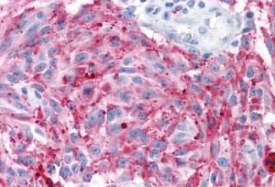 Immunohistochemistry-Paraffin: MRGPRD Antibody [NBP3-14409]