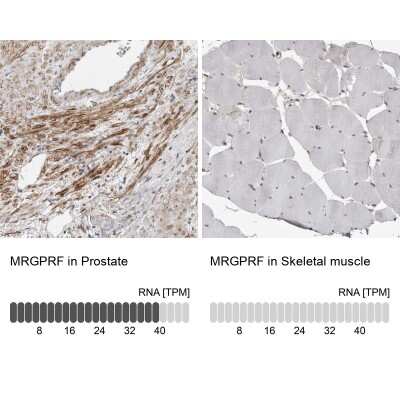 Immunohistochemistry-Paraffin: MRGPRF Antibody [NBP1-83341]