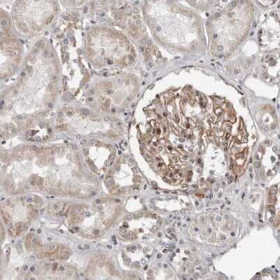 Immunohistochemistry-Paraffin: MRGPRF Antibody [NBP1-83341]