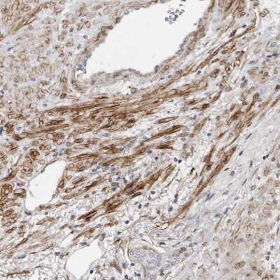 Immunohistochemistry-Paraffin: MRGPRF Antibody [NBP1-83341]