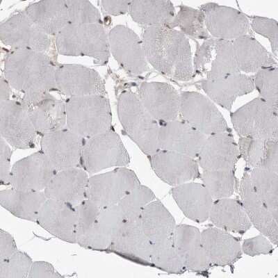 Immunohistochemistry-Paraffin: MRGPRF Antibody [NBP1-83341]