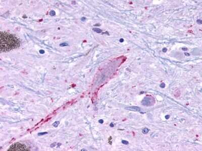 Immunohistochemistry-Paraffin: MRGPRF Antibody - BSA Free [NLS2173]