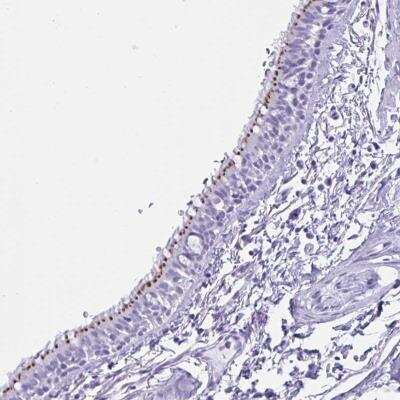 Immunohistochemistry-Paraffin: MRGPRG Antibody [NBP2-32405]