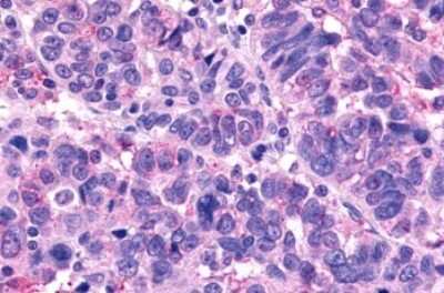 Immunohistochemistry-Paraffin: MRGX1 Antibody - BSA Free [NLS2756]
