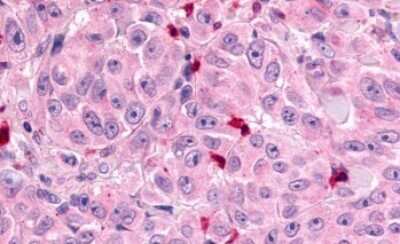 Immunohistochemistry-Paraffin: MRGX1 Antibody - BSA Free [NLS2756]