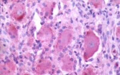 Immunohistochemistry-Paraffin: MRGX2 Antibody - BSA Free [NBP1-02668]