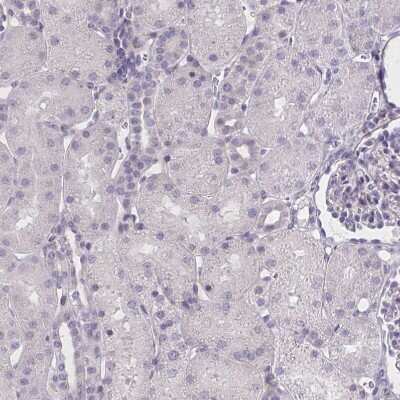 Immunohistochemistry-Paraffin: MRGX2 Antibody [NBP2-33744]