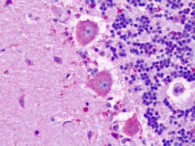 Immunohistochemistry-Paraffin: MRGX3 Antibody - BSA Free [NLS5120]